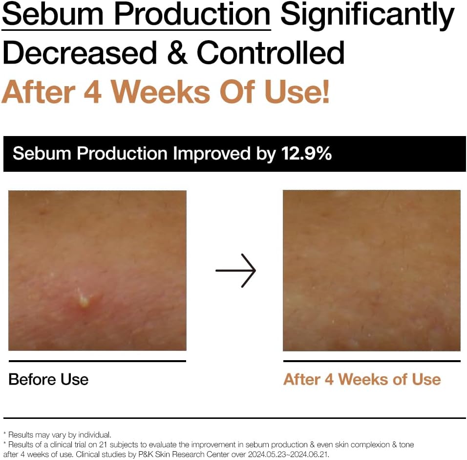 ANUA Rice 70 Glow Milky Toner – Hydrating & Brightening (250 ml / 8.45 fl oz)