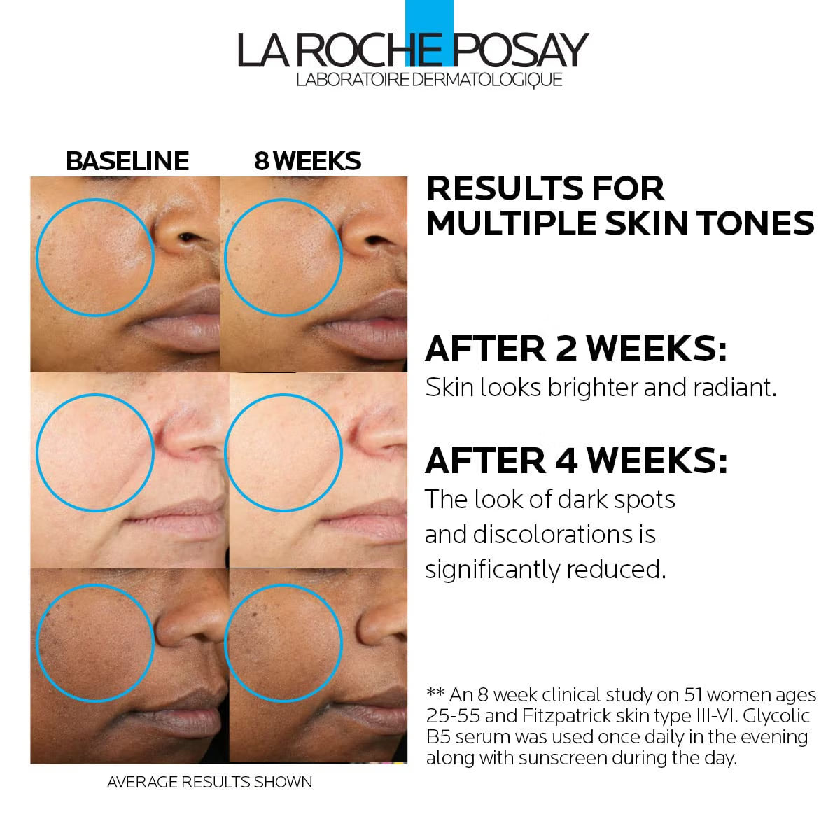 La Roche-Posay advertisement showing skin improvement over 8 weeks for multiple skin tones.