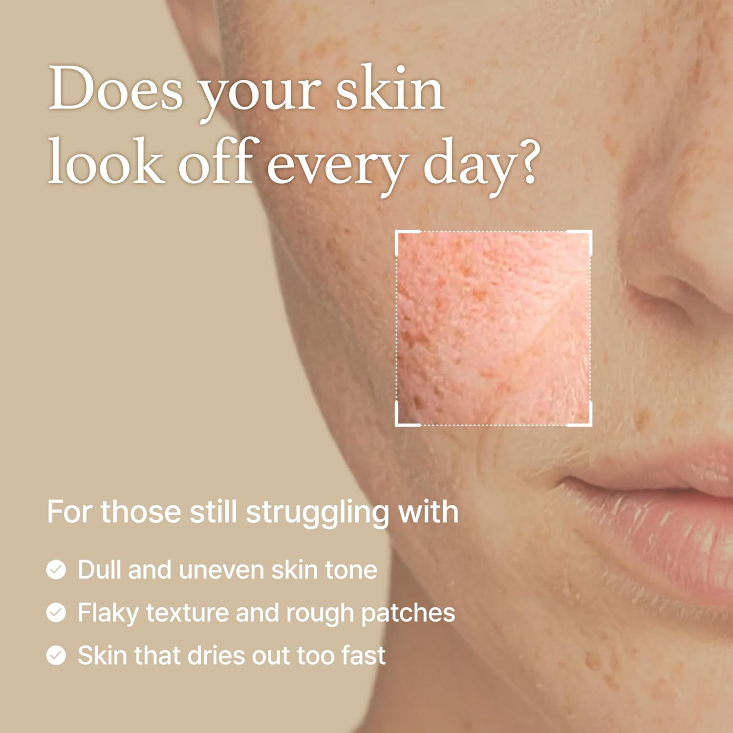 I’m From Rice Toner – Hydrating Milky Toner for Glowing Skin (5.07 fl oz)