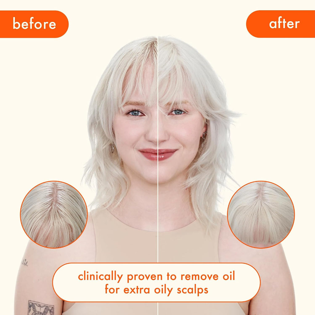 Amika | Extra Strength Dry Shampoo for Extra Oily Scalps