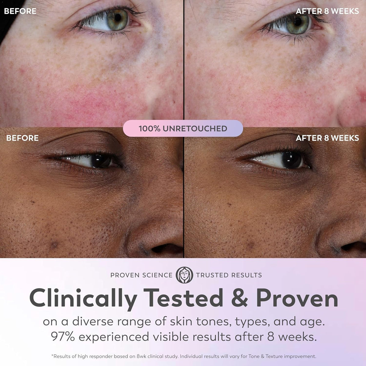 Olay | Super Serum 5-in-1 Daily Face Serum Niacinamide Vitamin C Collagen Peptide AHA Fragrance Free