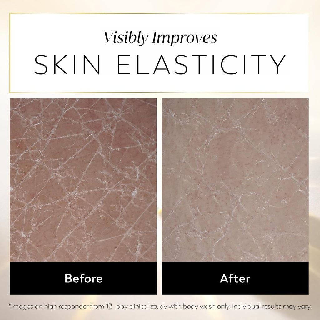 Before and after comparison graphic showing skin elasticity improvement, with the text 'Visibly Improves SKIN ELASTICITY' at the top and 'Before' and 'After' labels below two close-up skin texture photos.