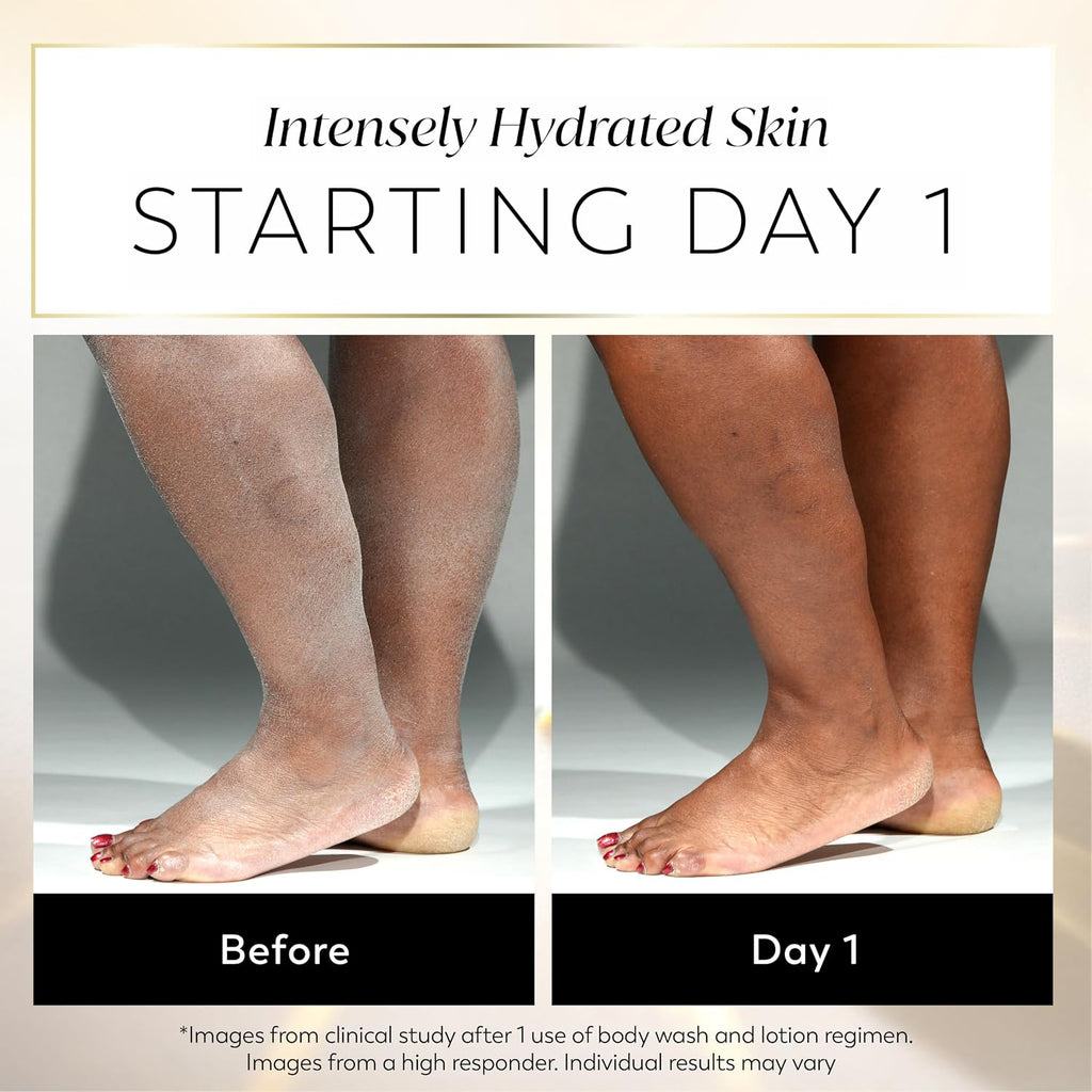 Before-and-after comparison of legs showing intensely hydrated skin, with the left leg appearing dry and flaky before and the right leg appearing smooth and hydrated after a day of use. Text at the top reads 'Intensely Hydrated Skin STARTING DAY 1'.