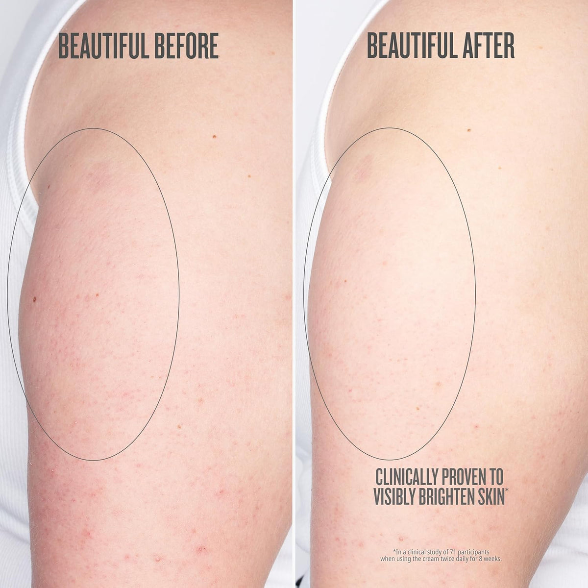 Before and after comparison of a person's leg with visible skin brightening effects.