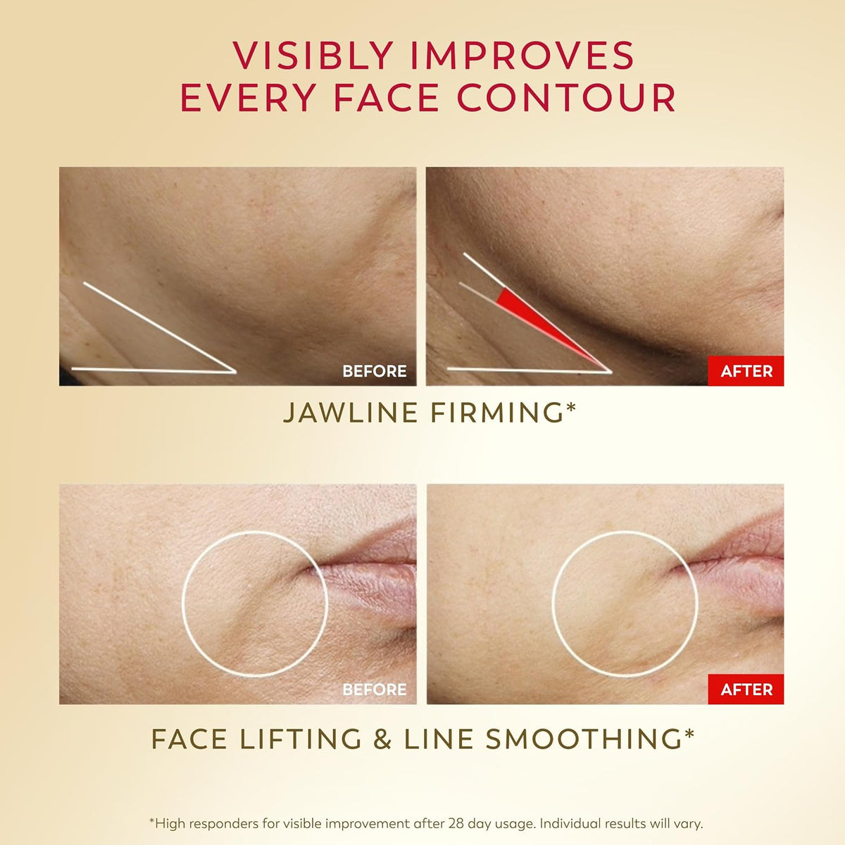 Before and after effects of jawline firming and face lifting on skin texture.