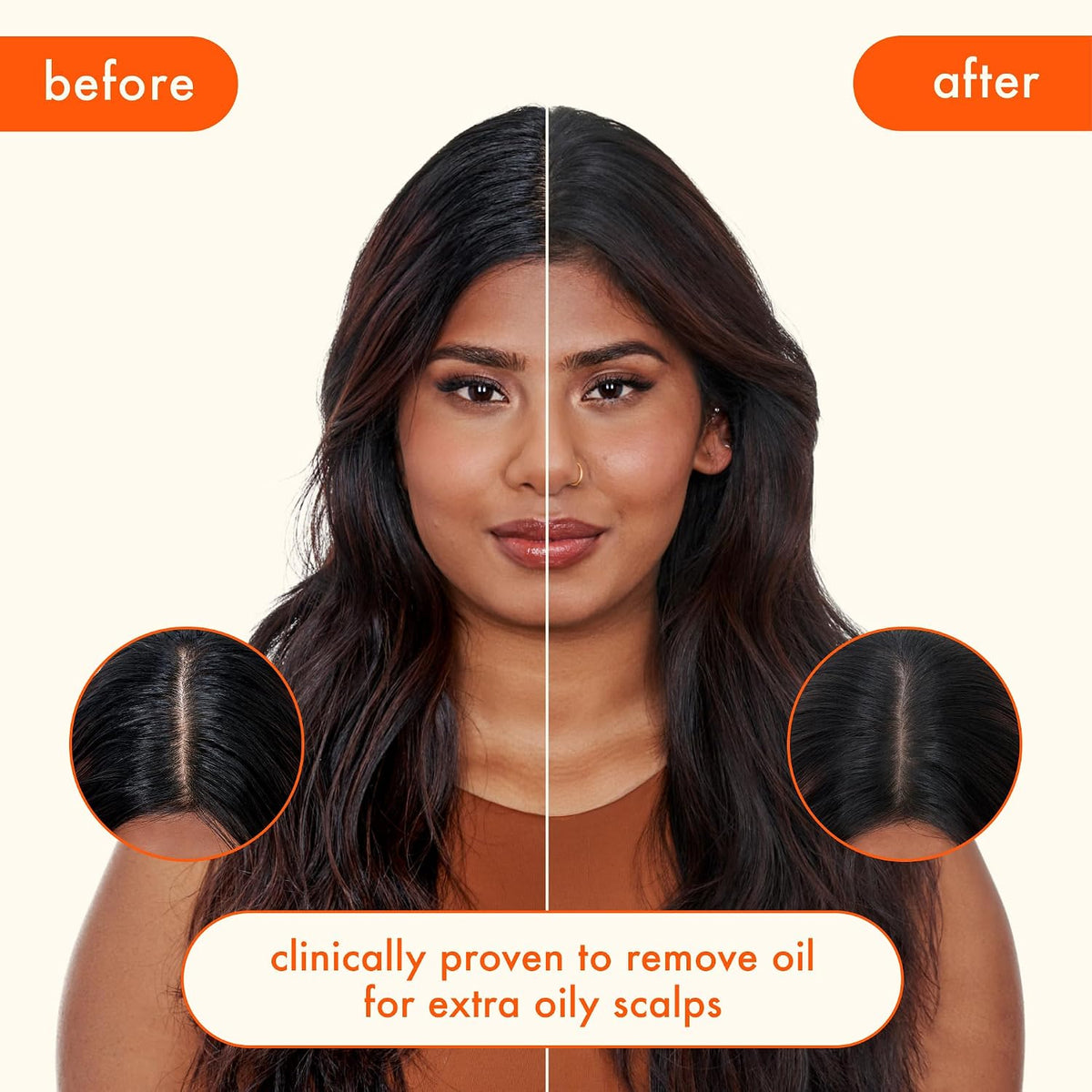 Amika | Extra Strength Dry Shampoo for Extra Oily Scalps