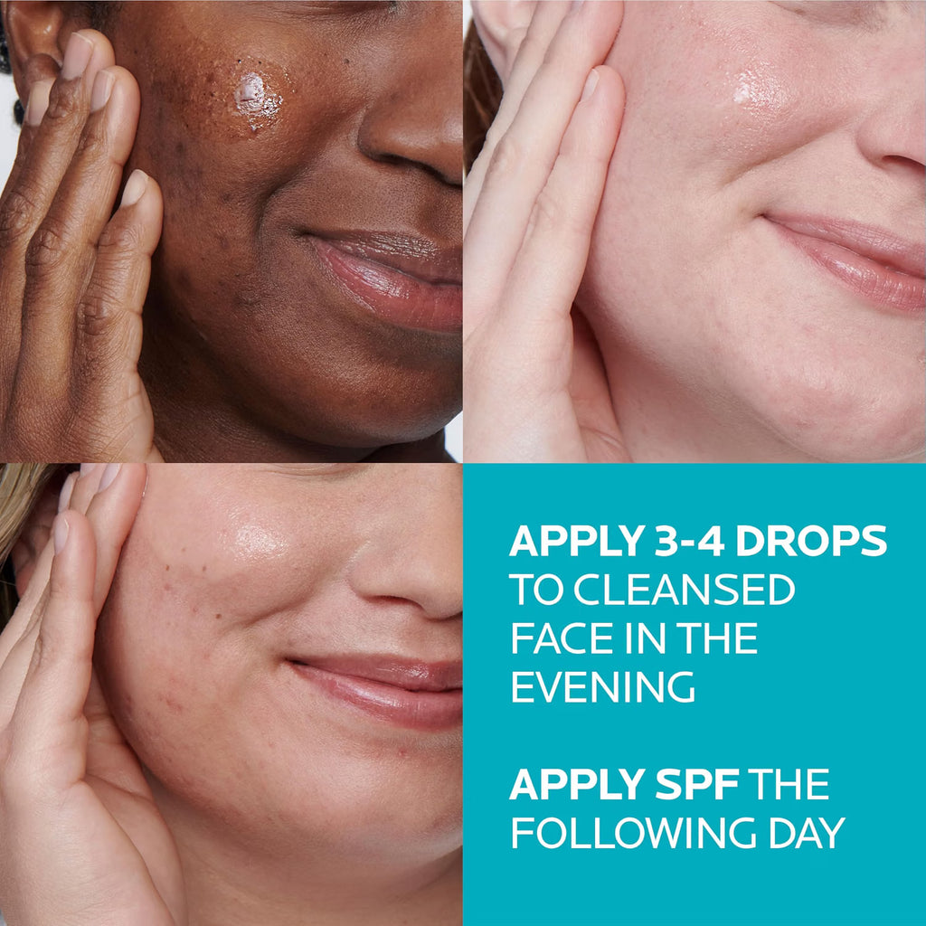 Collage of three faces with skin conditions, showing a skincare product application guide.