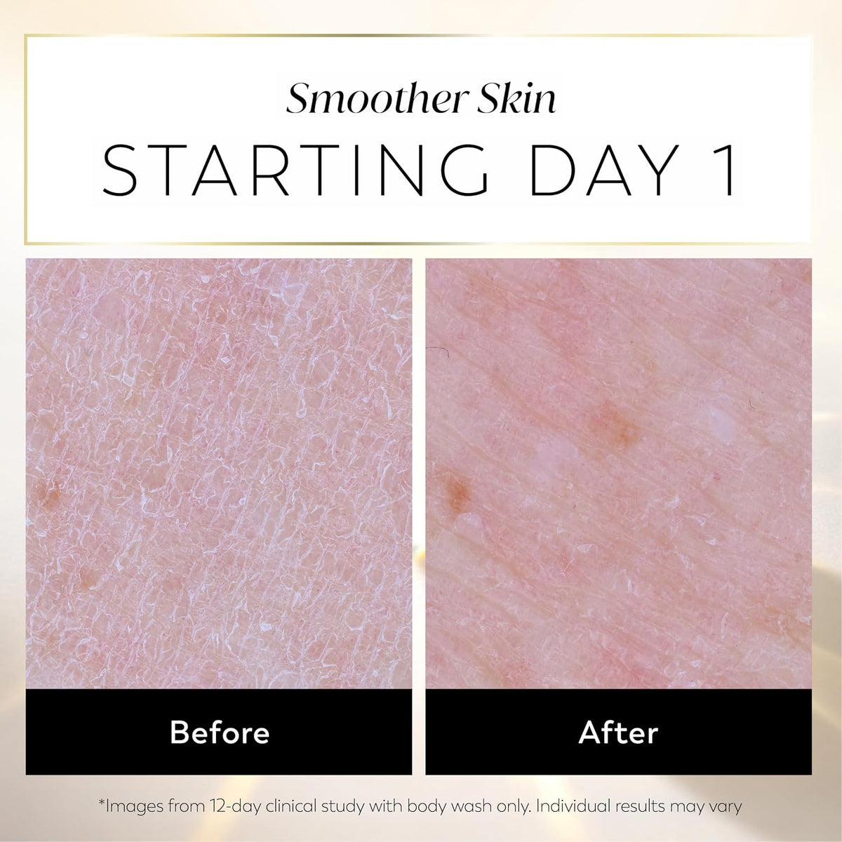Before and after comparison graphic showing close-up skin texture under the headline 'Smoother Skin STARTING DAY 1.' The left panel labeled 'Before' shows rough, dry skin, and the right panel labeled 'After' shows smoother, clearer skin.