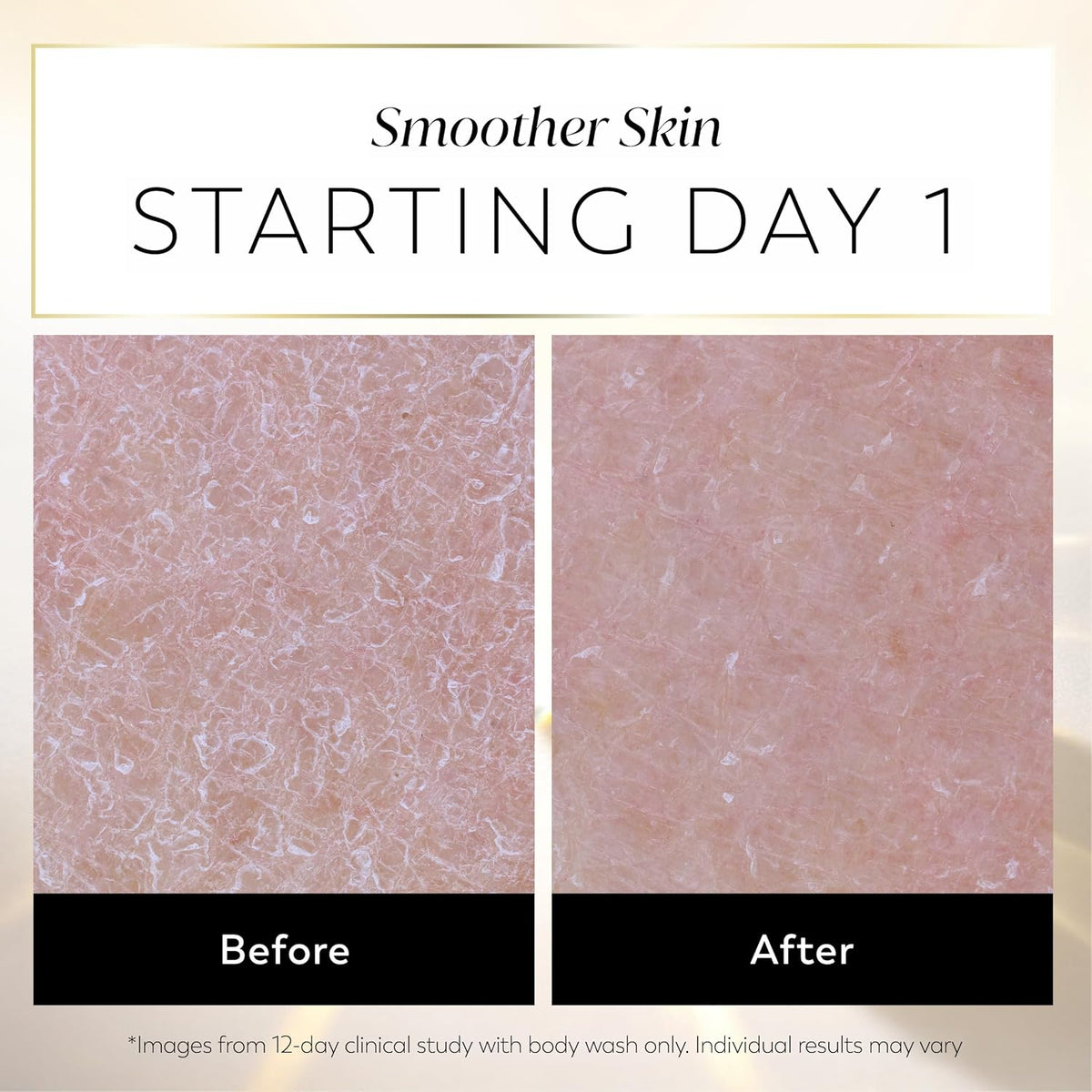 Before and after skin texture comparison graphic showing smoother skin results starting day 1, with the text 'Smoother Skin STARTING DAY 1' at the top and 'Before' and 'After' labels below the two close-up skin panels.
