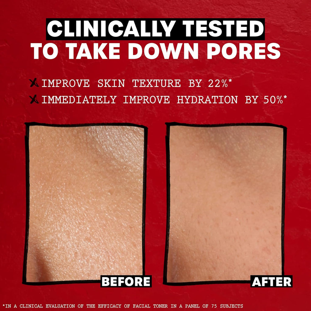 THAYERS Alcohol-Free Rose Petal Witch Hazel Facial Toner – 12 oz