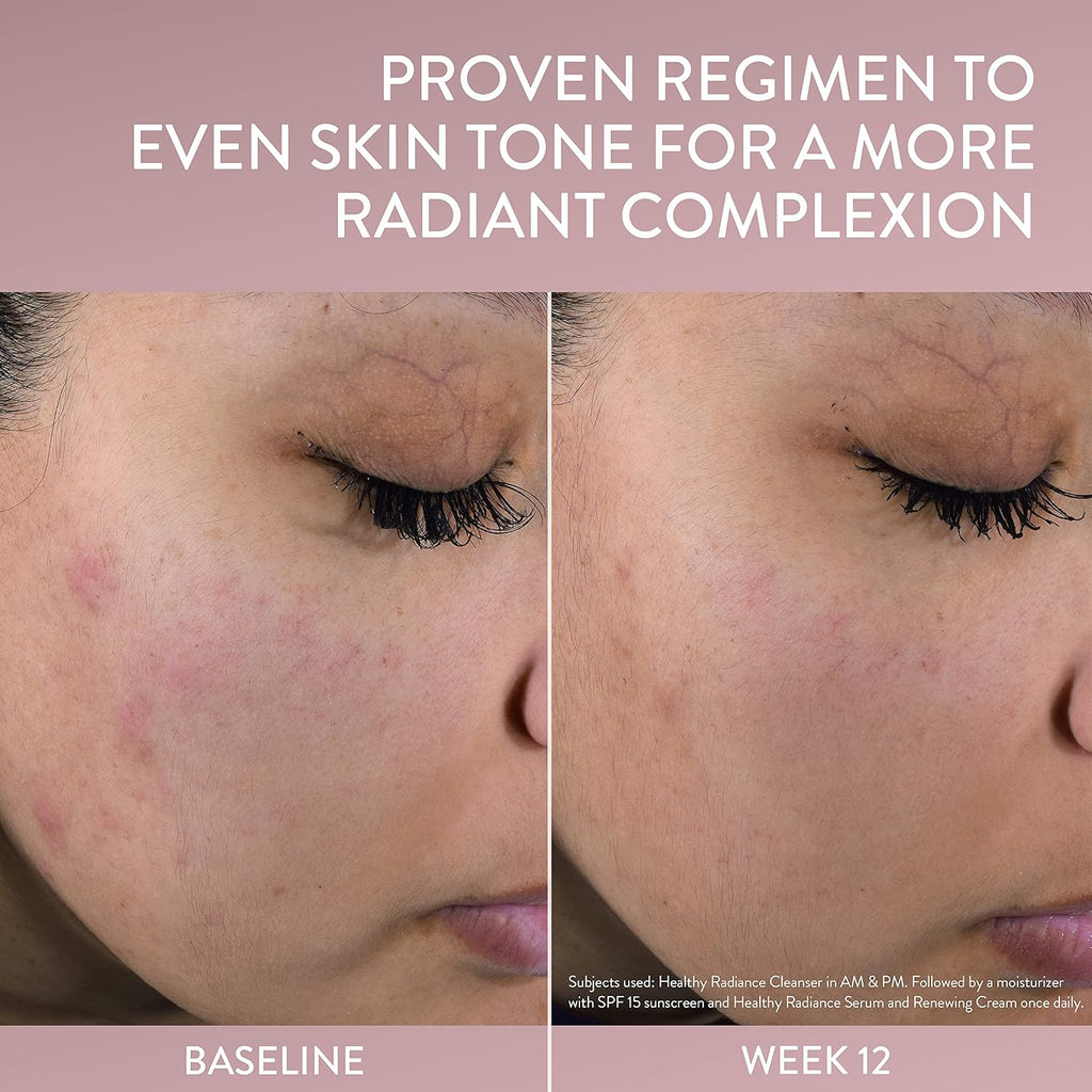 Before and after comparison of skin tone improvement with text on a beige background