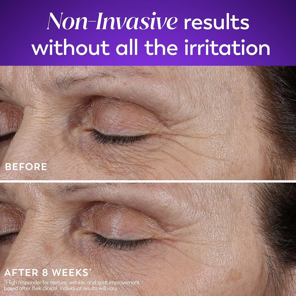 Before and after comparison of facial skin with text about non-invasive results.