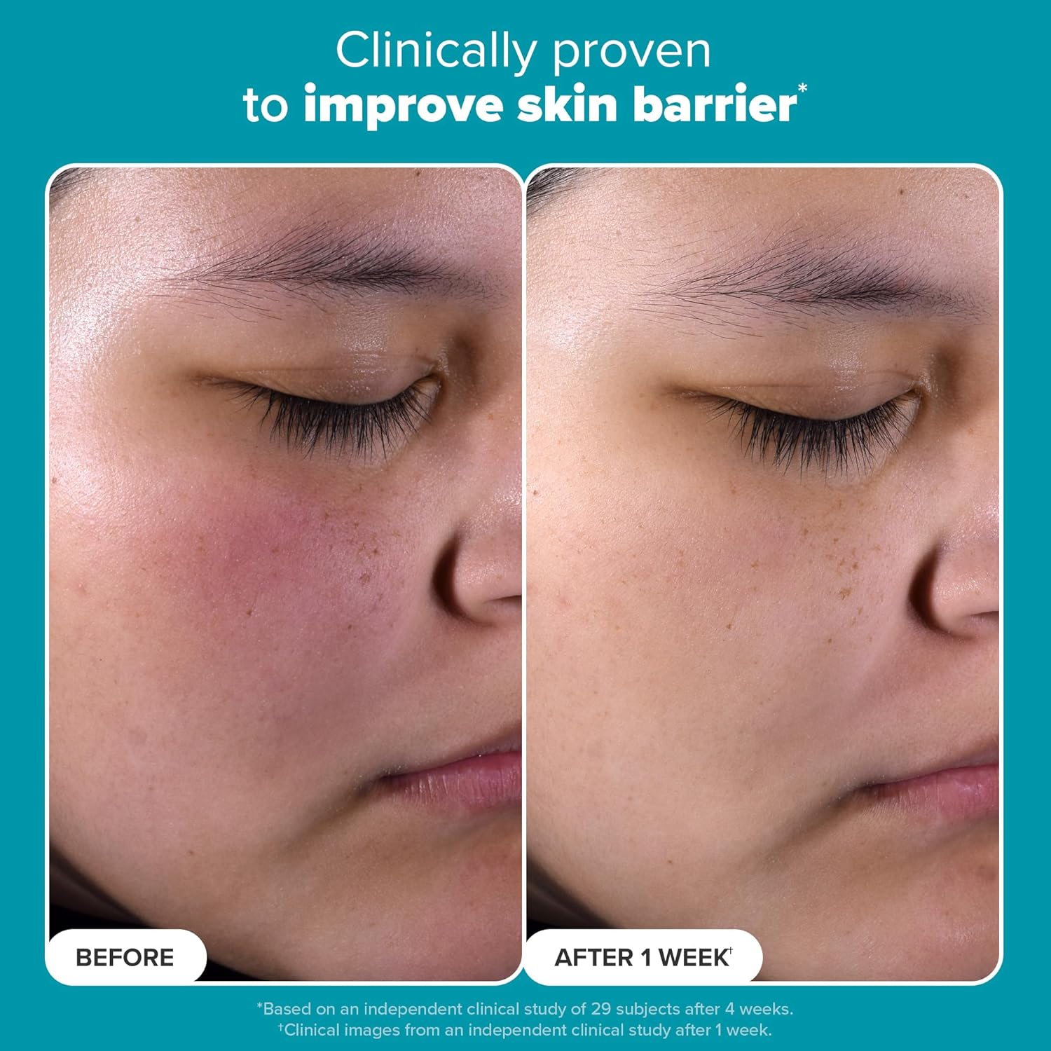 Paula’s Choice Skin Perfecting 2% BHA Liquid Exfoliant (Fragrance-Free)