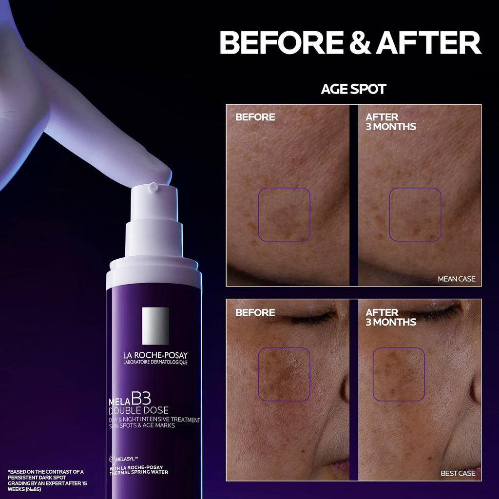 Mela B3 Double Dose Dark Spot Anti-Aging Treatment by La Roche-Posay — 40ml (1.35 fl oz)