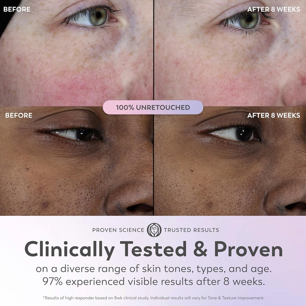 Olay | Super Serum 5-in-1 Daily Brightening Glow Face Serum Niacinamide Vitamin C Collagen Peptide AHA