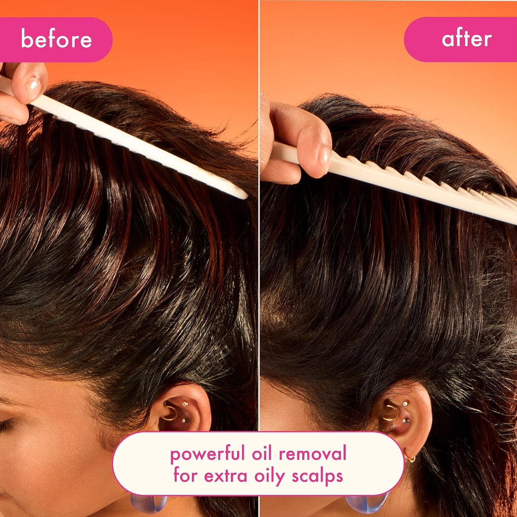Amika | Extra Strength Dry Shampoo for Extra Oily Scalps
