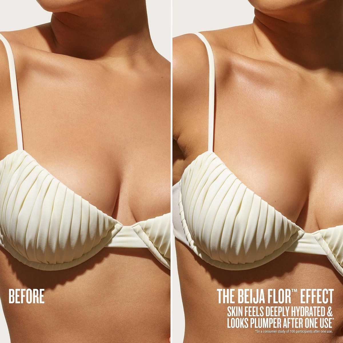 Before and after comparison of a woman wearing a white bikini top, highlighting the 'Beija Flor' effect on skin hydration and plumpness.