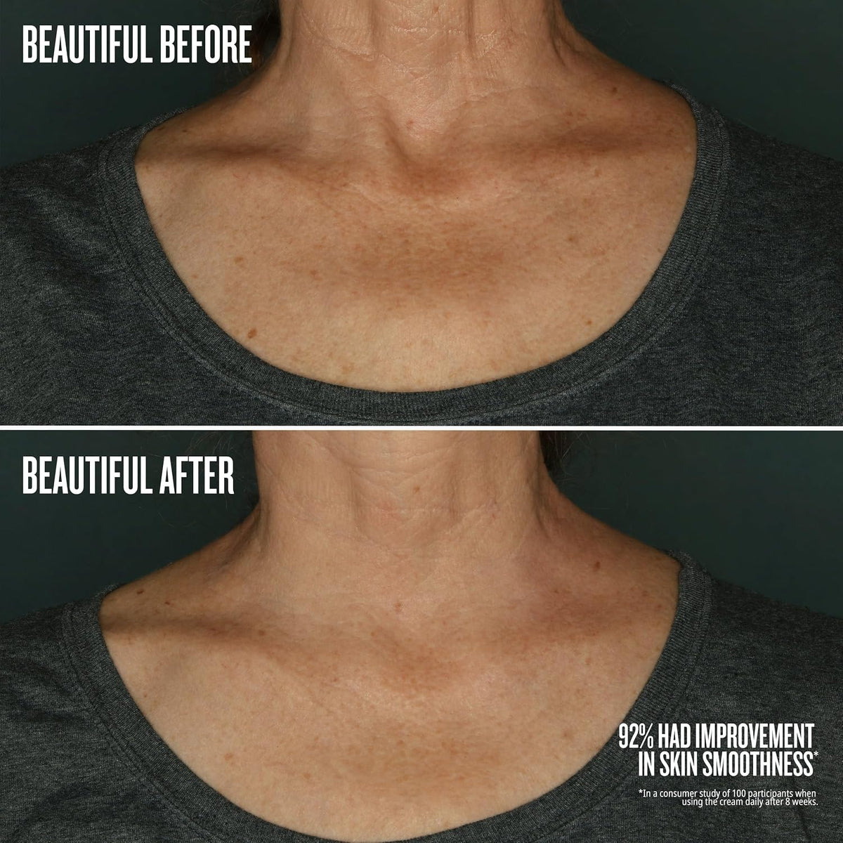 Before and after comparison of neck skin smoothness with text indicating improvement.