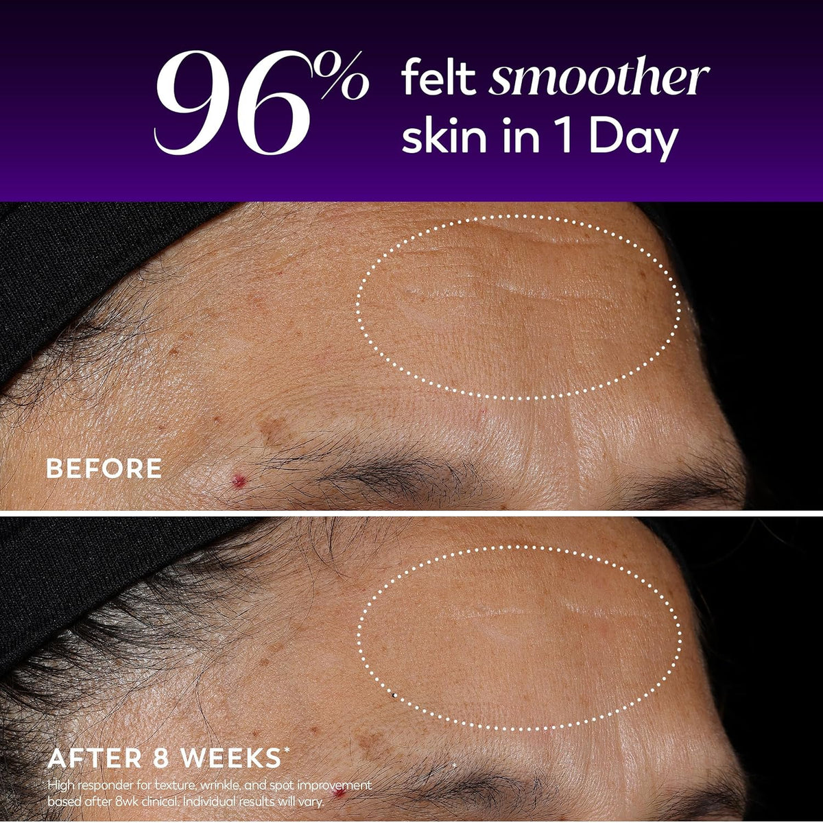 Before-and-after skin texture comparison on a person's forehead, with a purple headline reading '96% felt smoother skin in 1 Day' and text noting results after 8 weeks.