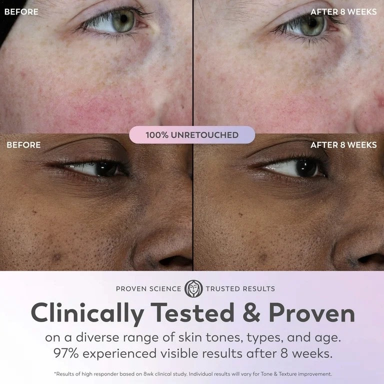 Olay Super Serum - Niacinamide, Vitamin C & E, Collagen Peptide, AHA - 5-in-1 Skin Care Benefits for Face - Healthy Glow, Brightening, Hydrating, Smoothing, Firming, Evens Tone, Anti-Aging, 1.0 Oz