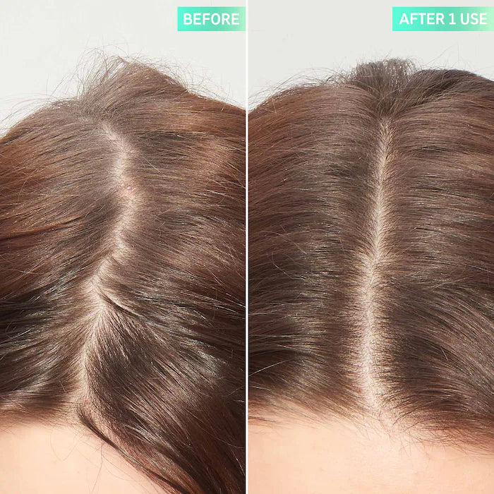 The INKEY List  Glycolic Acid Exfoliating Scalp Scrub