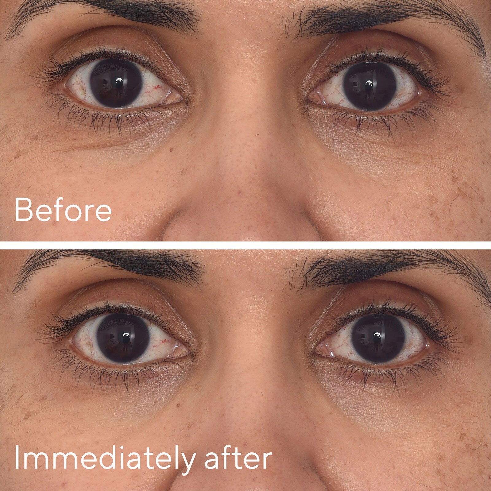 Before-and-after close-up comparison of a person's eyes, with the top panel labeled 'Before' and the bottom panel labeled 'Immediately after' on a skin-toned background.