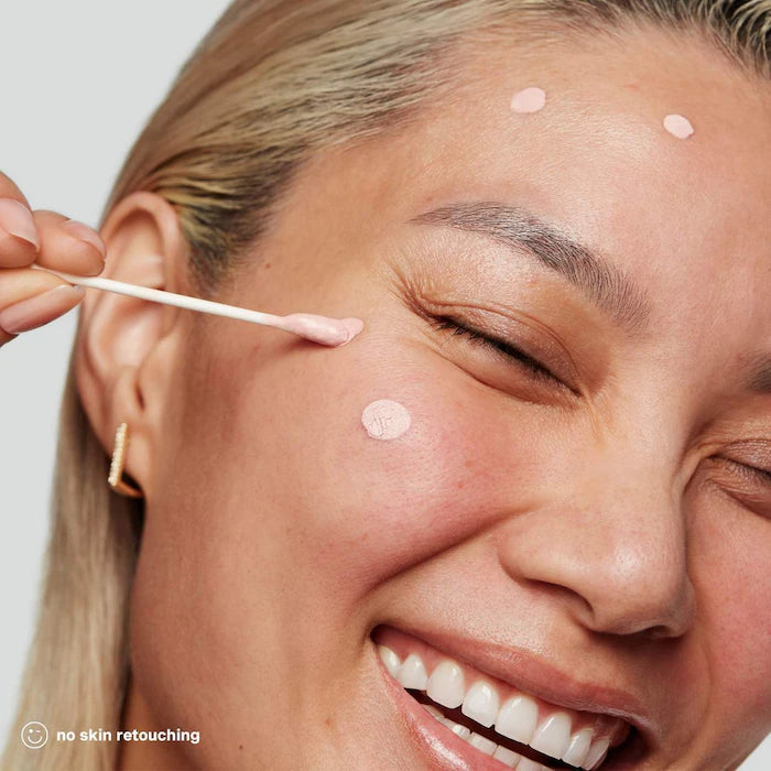 EradiKate™ Acne Spot Treatment with 10% Sulfur