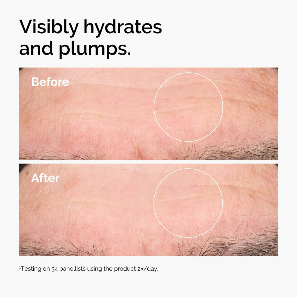 The Ordinary 
Hyaluronic Acid 2% + B5 Hydrating Serum with Ceramides
