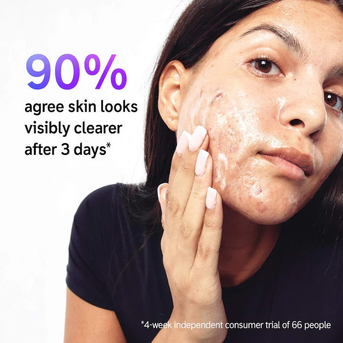 Salicylic Acid Acne + Blackhead Cleanser