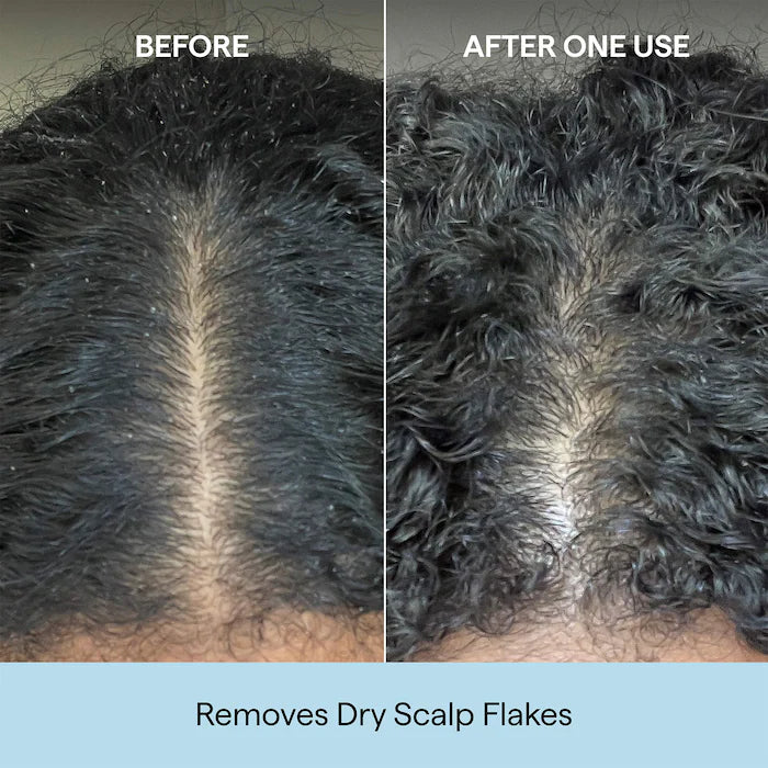 Briogeo - Scalp Revival Charcoal + Coconut Oil Micro-exfoliating Scalp Scrub Shampoo