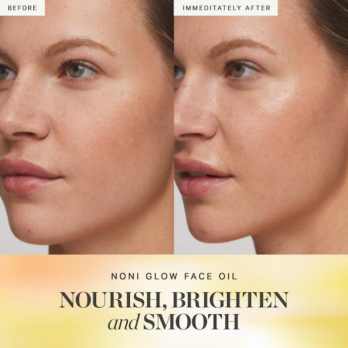 KORA Organics - Noni Glow Radiant Face Oil with Antioxidants