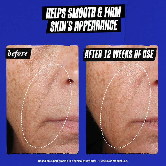 Kiehl's Since 1851 - Midnight Recovery Concentrate Moisturizing Face Oil Serum