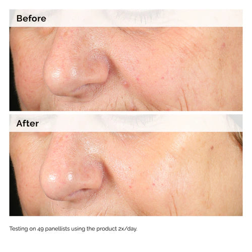 The Ordinary - Alpha Arbutin 2% + Hyaluronic Acid for Hyperpigmentation