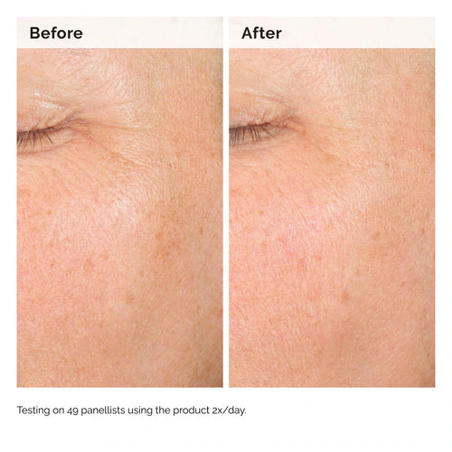  The Ordinary - Alpha Arbutin 2% + Hyaluronic Acid for Hyperpigmentation