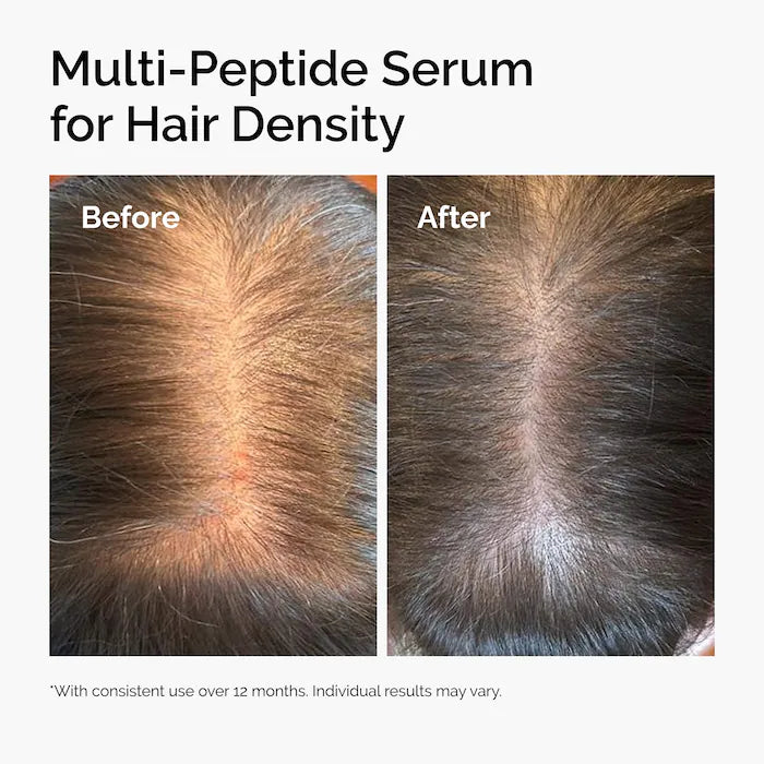 The Ordinary - Multi-Peptide Serum for Hair Density for Thicker, Fuller Looking Hair