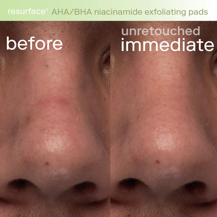 Skinfix - Resurface+ AHA/BHA Niacinamide Exfoliating Pads for Face and Targeted Body