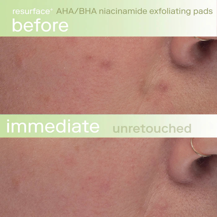 Skinfix - Resurface+ AHA/BHA Niacinamide Exfoliating Pads for Face and Targeted Body