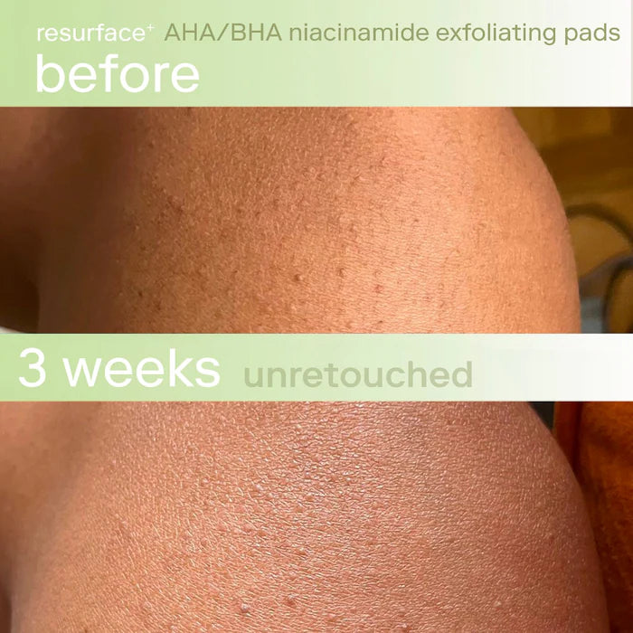 Skinfix - Resurface+ AHA/BHA Niacinamide Exfoliating Pads for Face and Targeted Body