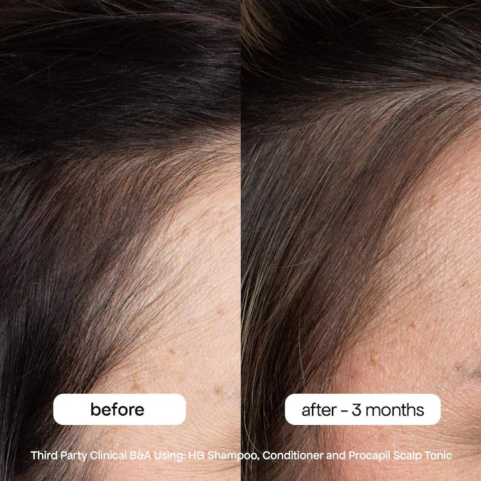 BondiBoost - HG Shampoo for Thinning Hair with Rosemary