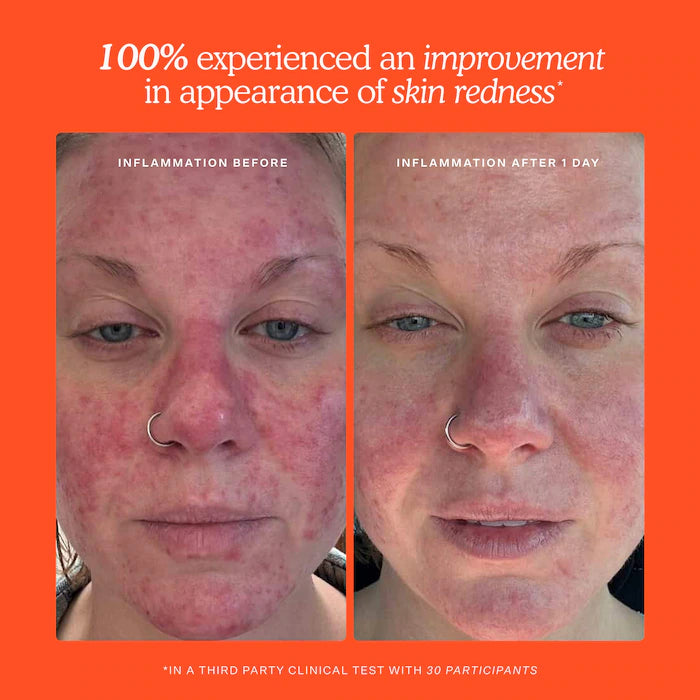 Tower 28 Beauty - SOS Daily Hypochlorous Acid Spray for Breakouts & Redness