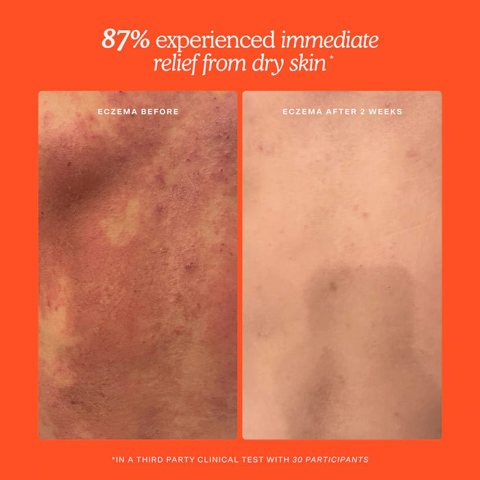 Tower 28 Beauty - SOS Daily Hypochlorous Acid Spray for Breakouts & Redness