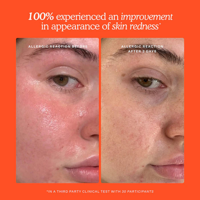 Tower 28 Beauty - SOS Daily Hypochlorous Acid Spray for Breakouts & Redness