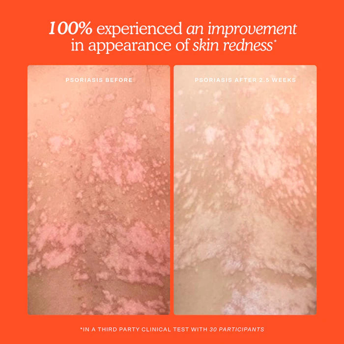 Tower 28 Beauty - SOS Daily Hypochlorous Acid Spray for Breakouts & Redness