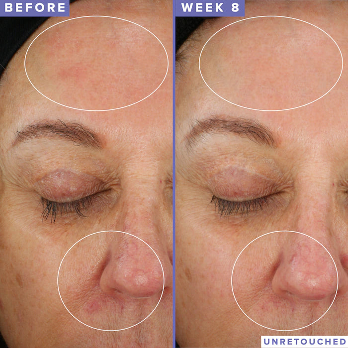 Farmacy - 10% Niacinamide Night Mask