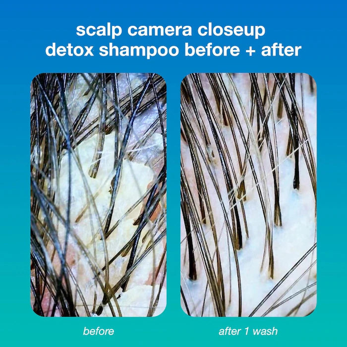 K18 Biomimetic Hairscience - PEPTIDE PREP™ Clarifying Detox Shampoo