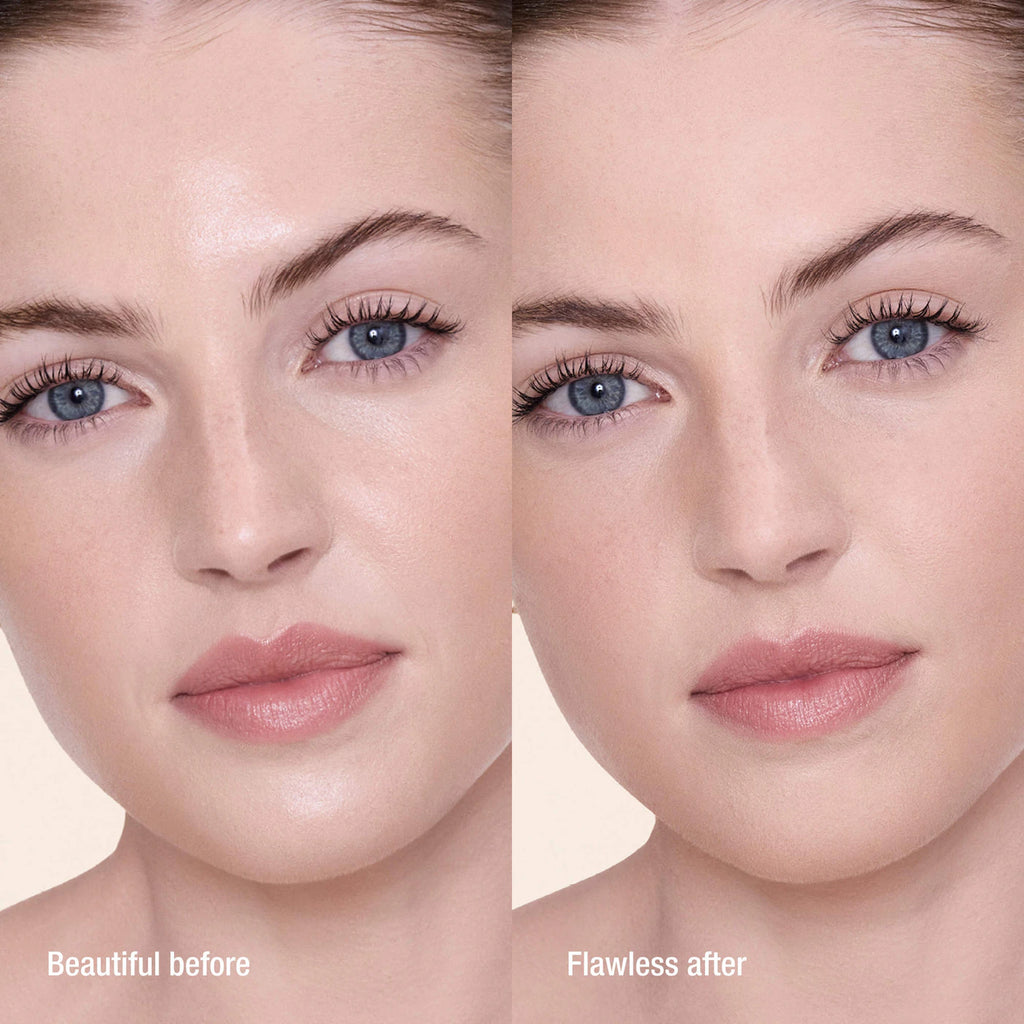 Before and after comparison of a woman's face with text indicating 'Beautiful before' and 'Flawless after'.