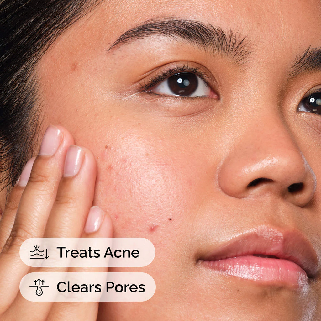 The Ordinary 
Salicylic Acid 2% Solution, Exfoliating Serum for Acne