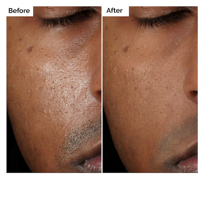 The Ordinary - Aloe 2% + NAG 2% Solution for Post-Acne Marks