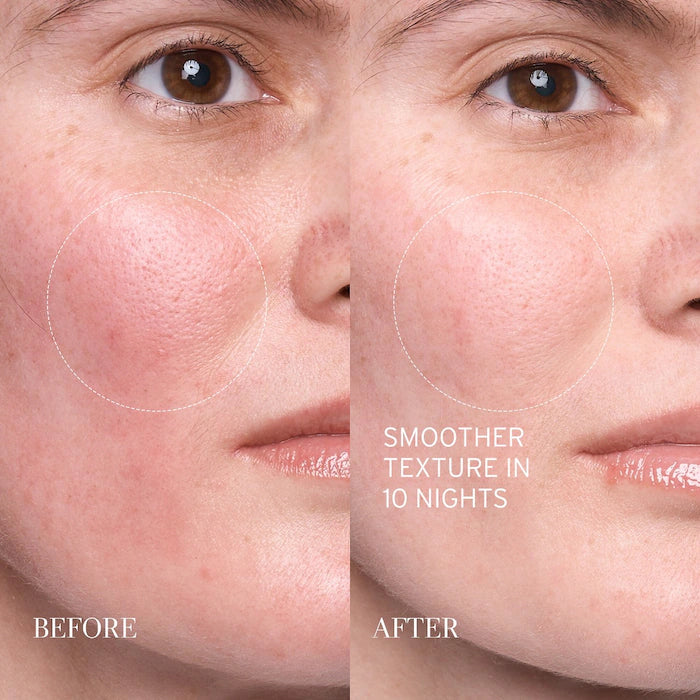 fresh - Lotus AHA Resurfacing Gentle Serum