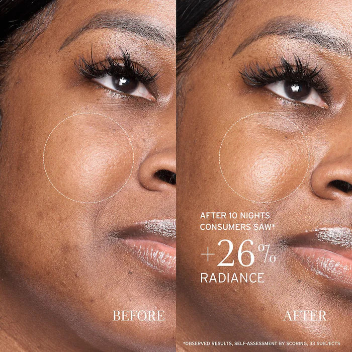 fresh - Lotus AHA Resurfacing Gentle Serum